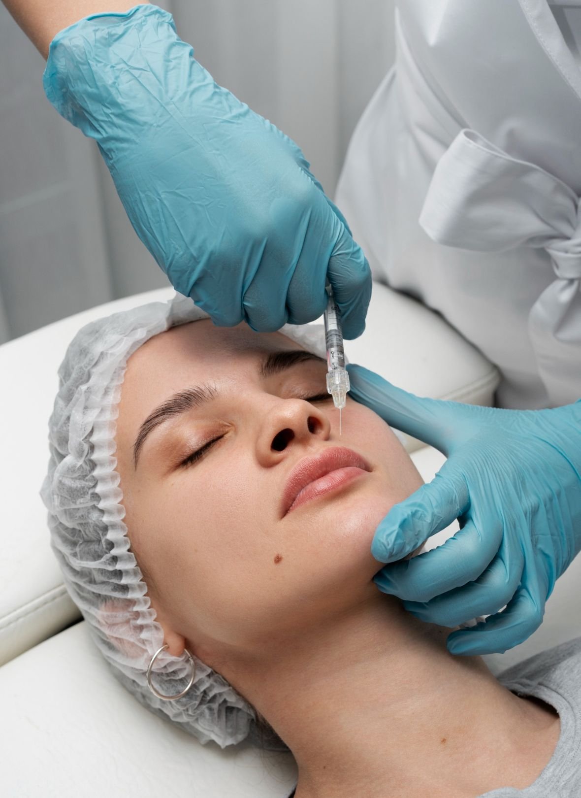 Dermal Fillers