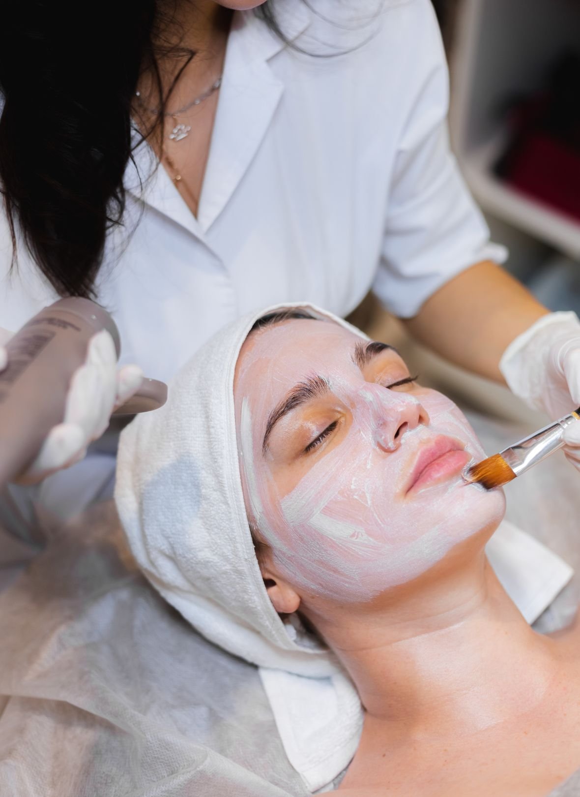 chemical peel bardford
