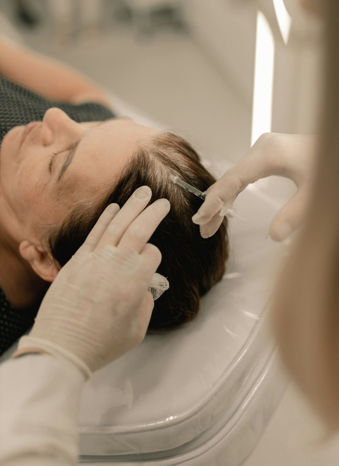 Platelet Rich Plasma (PRP) Hair Loss Treatment